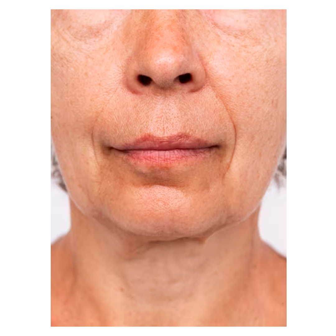 Antes bigode chinês